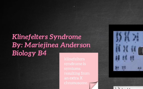 Klinefelter's syndrome is the set of symptoms resulting from by ...