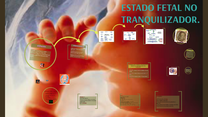 Estado Fetal No Tranquilizador Cie 10