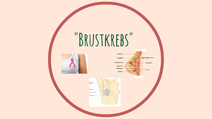 Brustkrebs by on Prezi