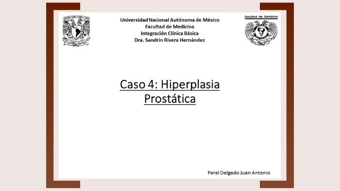 capas histologicas de la prostata capas histologicas de la prostata