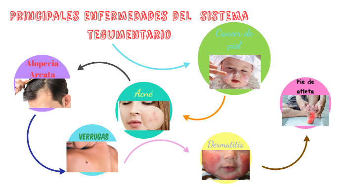 Principales enfermedades del sistema tegumentario by Karla Davila on Prezi