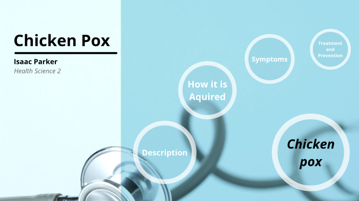 Chicken Pox by Isaac Parker on Prezi