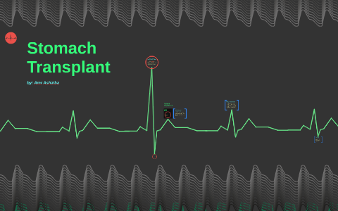 Stomach Transplant by Amr ashaiba