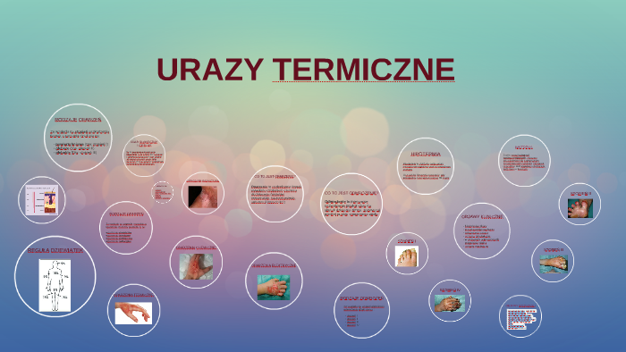 Edb Sprawdzian Gimnazjum Urazy Termiczne prezi.com