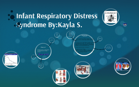 Infant Respiratory Distress Syndrome By:Kayla S. by Kayla Sowells on Prezi