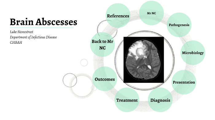 Brain Abscesses by Luke Stonestreet on Prezi