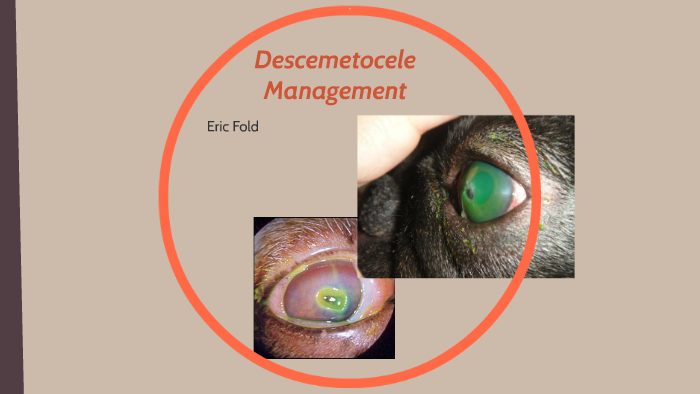 Descemetocele Management by Eric Fold on Prezi