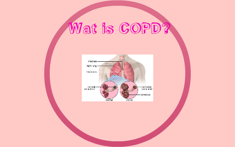 Wat is COPD? by Hendrika van Wijk on Prezi