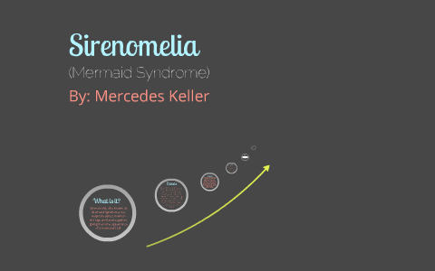 Sirenomelia (Mermaid Syndrome) by Mercedes Keller