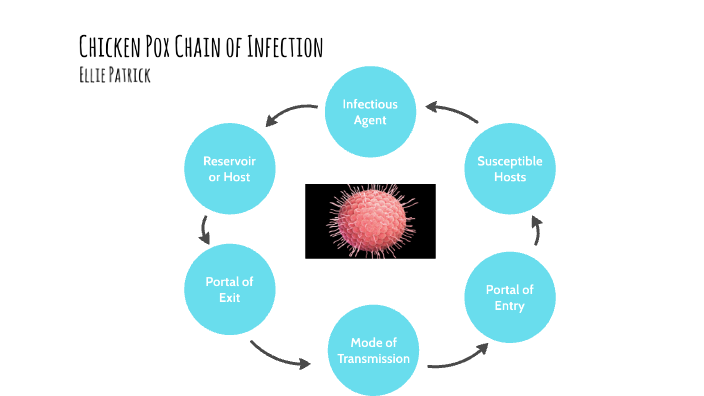 Chicken pox by Ellianne Patrick on Prezi