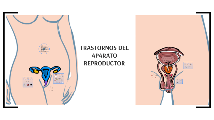 Que es clamidiasis wikipedia