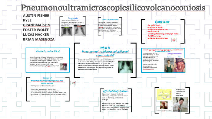 Pneumonoultramicroscopicsilicovolcanoconiosis by Foster Wolff on Prezi