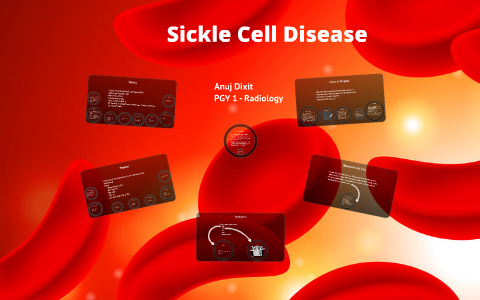 Sickle Cell Disease by Anuj Dixit on Prezi