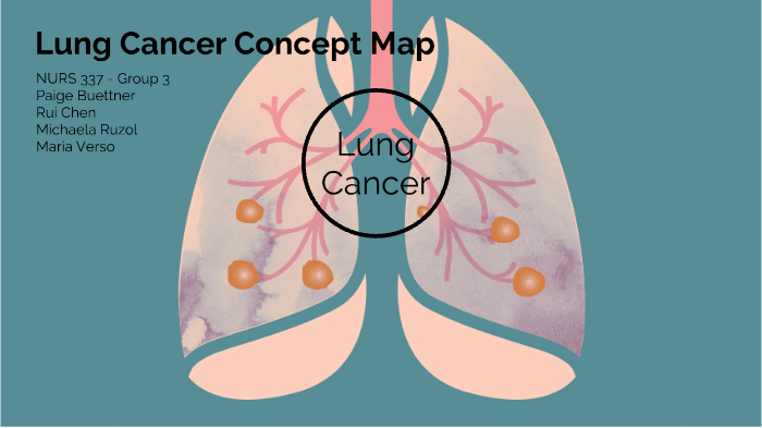 Lung Cancer by Michaela Ruzol on Prezi