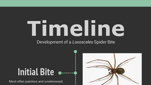 Spider Bite Timeline by on Prezi Design