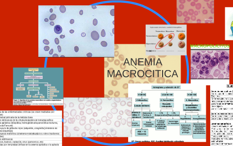 ANEMIA MACROCITICA by Ana Sirley Calderon Flores on Prezi