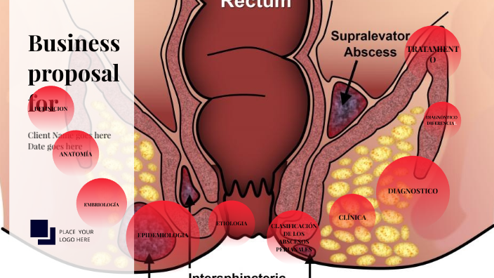 absceso perianal femenino