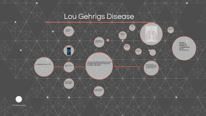 Lou Gehrigs Disease By Rebekah Babcock 2982