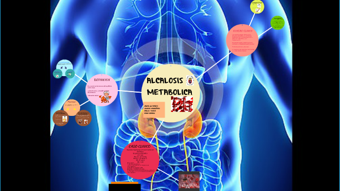 Alcalosis Metabolica by Juliana Madroñero on Prezi