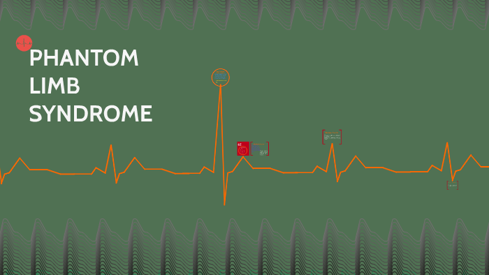 PHANTOM LIMB SYNDROME By Brayden Akers On Prezi