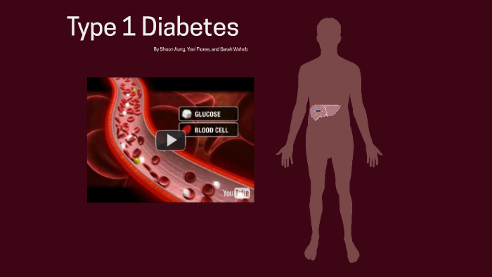 Type 1 Diabetes by Yael Flores on Prezi