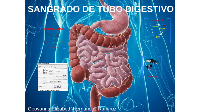 SANGRADO DE TUBO DIGESTIVO by geovanna hernandez on Prezi