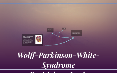 Wolff-Parkinson-White-Syndrome by Dana Monday