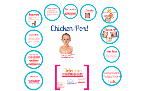 Chicken Pox by Morgan Miller on Prezi