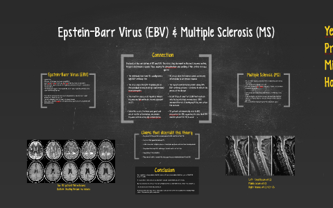Epstein Barr Virus Ebv Multiple Sclerosis Ms By Yeni