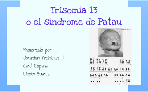 El S ndrome De Patau O Trisom a Del Cromosoma 13 By Jarcher Arciniegas el-s-ndrome-de-patau-o-trisom-a-del-cromosoma-13-by-jarcher-arciniegas