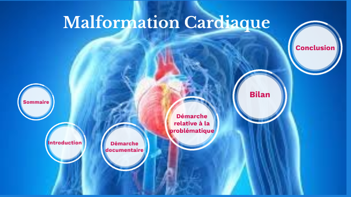 Malformation Cardiaque By Lisa Lapeyrie