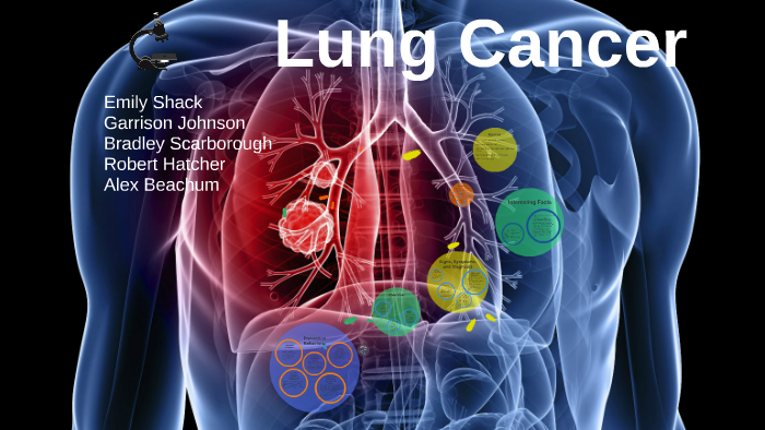 Lung Cancer by on Prezi