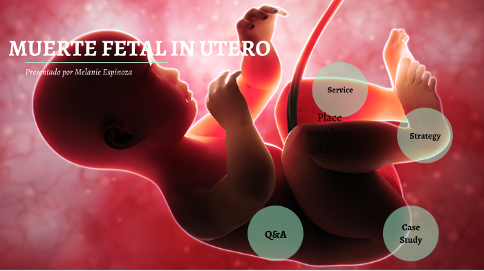 muerte-fetal-in-utero-by-melanie-espinoza