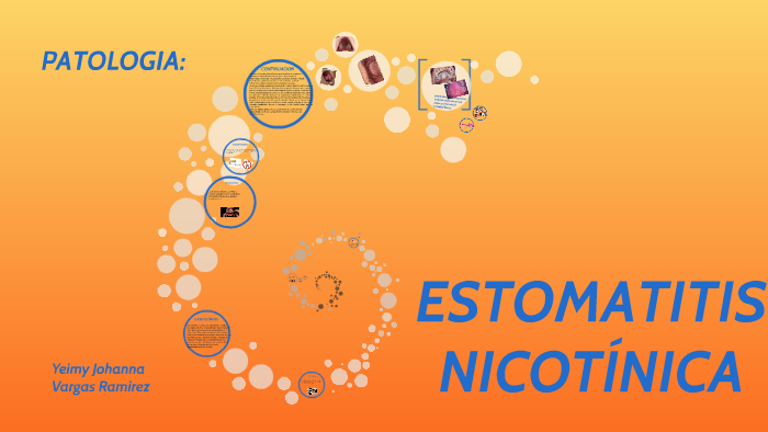 estomatitis nicotínica