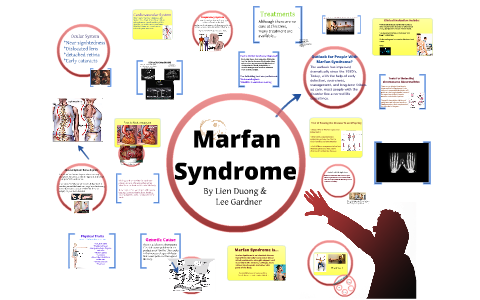 Marfan Syndrome by Lien Duong
