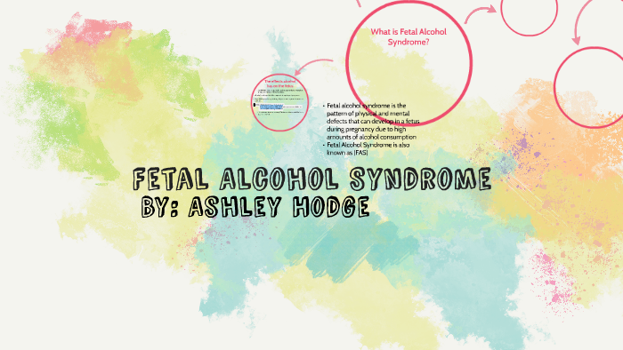 Fetal Alchol Syndrome By Sinde Reardon 7744