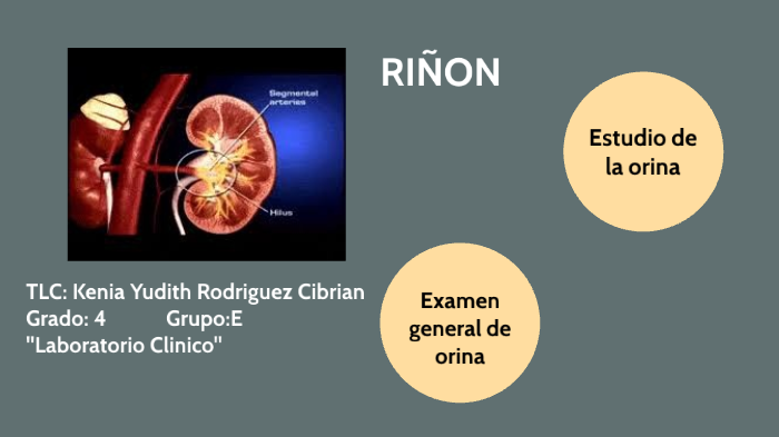 Riñon y examen general de orina.Kenia Rodríguez by Karely Haro on Prezi