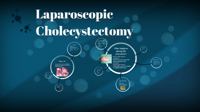 Laparoscopic Cholecystectomy by Liv Ryan on Prezi