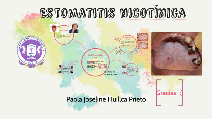 estomatitis nicotínica