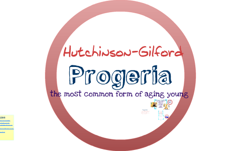 Progeria Aging Chart
