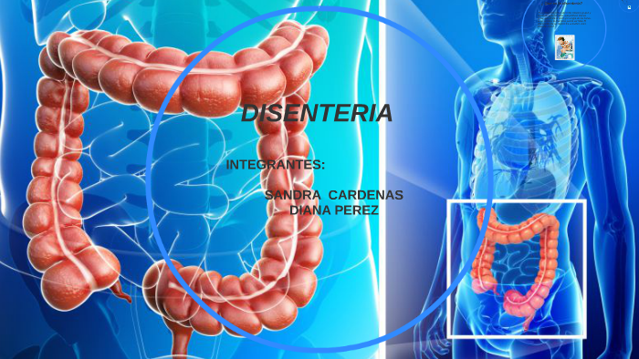 DISENTERIA by DIANA PEREZ on Prezi