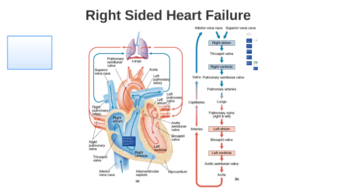 right-sided-heart-failure-by-jon-carrick