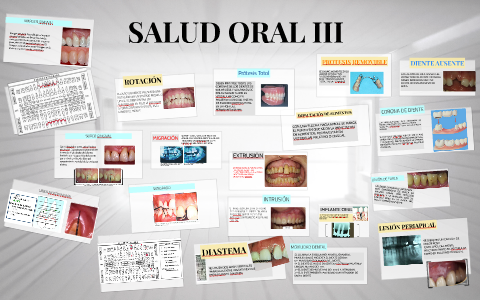 Margen Gingival By Augusto Lopez Marmolejo On Prezi Next