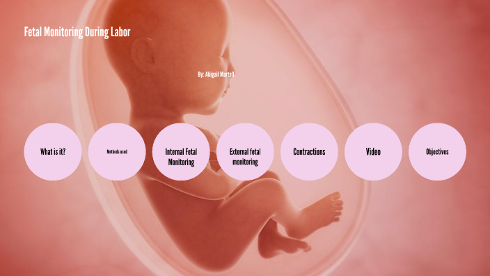Fetal Monitoring During Labor By ABBY MARTELL