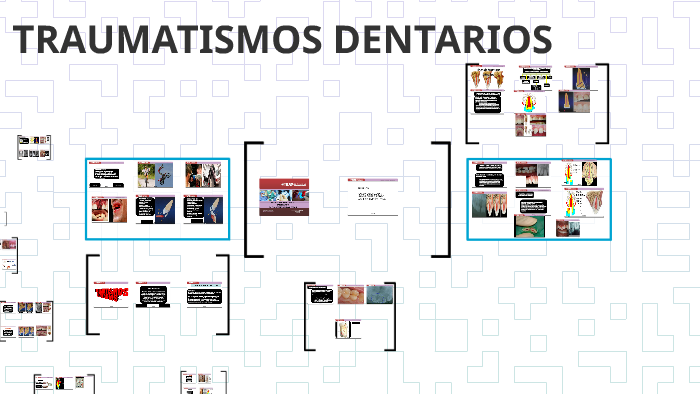 TRAUMATISMOS DENTARIOS By Juan Manuel Sanca Quispe On Prezi