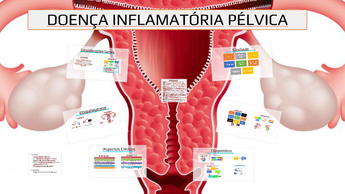 Dr. Carlos Roberto - Ginecologia - A DIPA (Doença Inflamatória Pélvica  Aguda) é uma infecção dos órgãos reprodutivos femininos (útero, trompas e  ovários). ▫ A DIPA ocorre quando bactérias patogênicas proliferam na