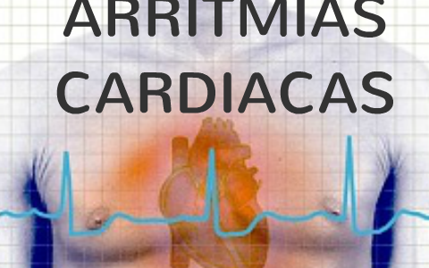 ARRITMIAS CARDIACAS by Roger Moreno Barreto on Prezi