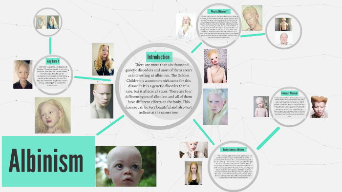 Albinism by Jackson Diggs on Prezi