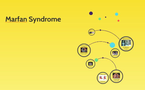 Marfan Syndrome and Connective Tissue by Jake Bleecker