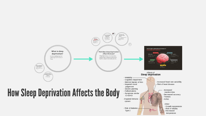 How Sleep Deprivation Affects the Brain by mia schmitz on Prezi